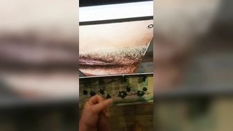 Für Hairy