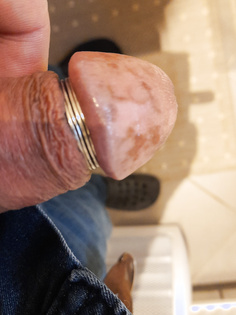 Penis mit Eichelring