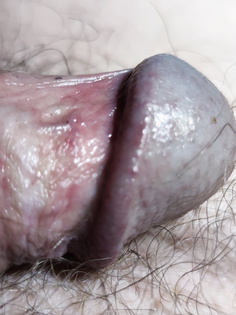 Kleiner Penis