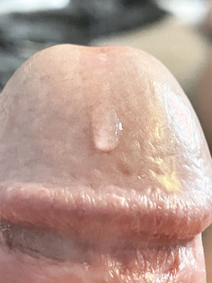 Beim abspritzen