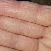 Spinge