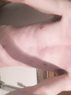 Fotoalbum von mein Körper.
