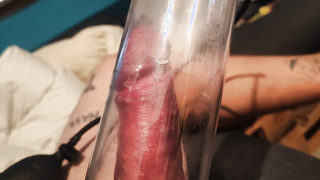 Penispumpe